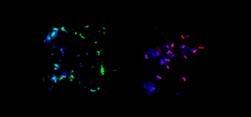 PNA (Peptide nucleic acids)